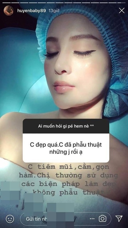 View -             Bị chê 'mặt nhựa' do tiêm botox, Huyền Baby phản ứng cực căng    